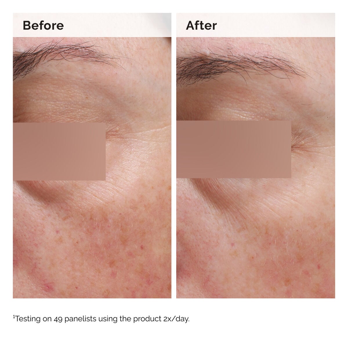 5% Face and Body Emulsion - Daily Care