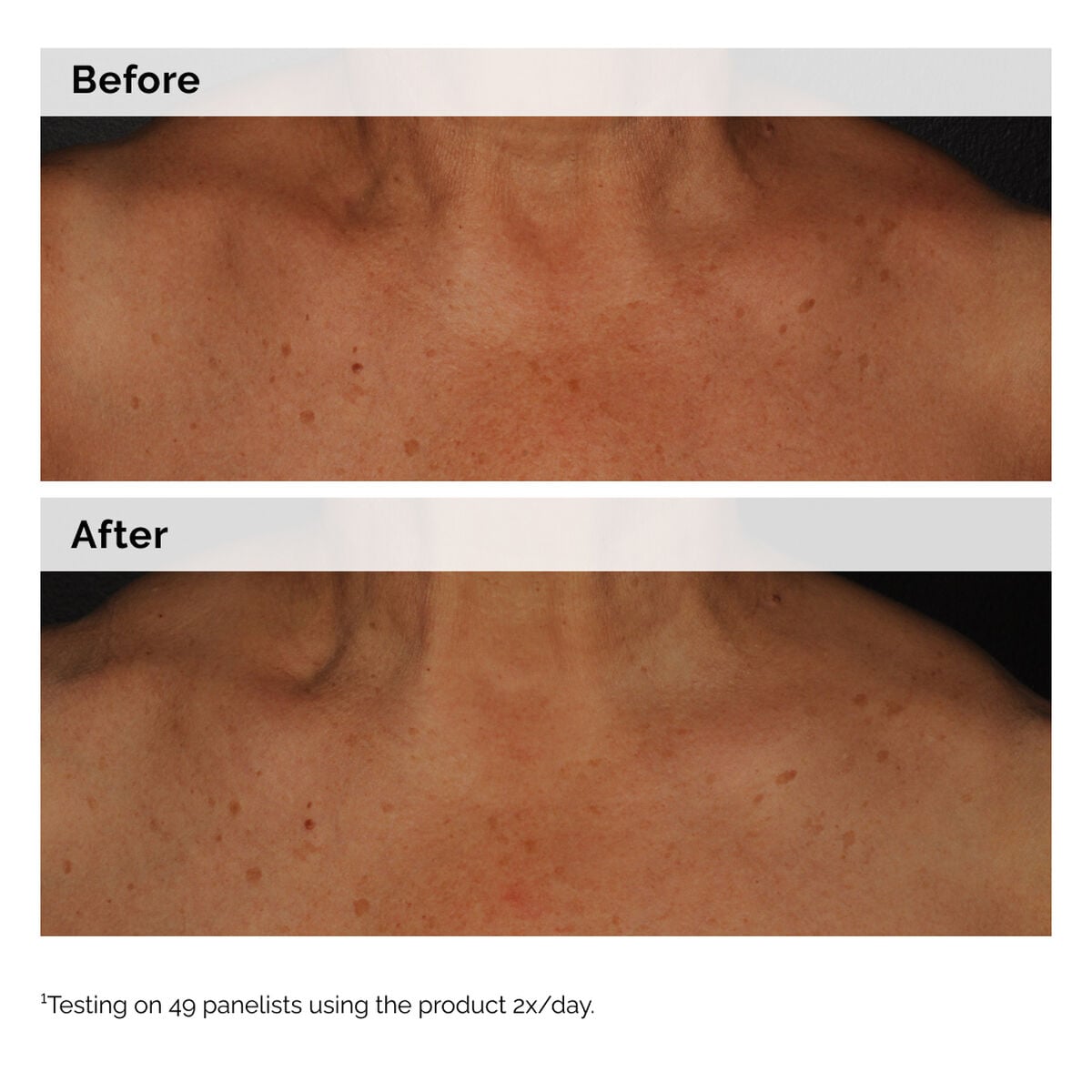 5% Face and Body Emulsion - Daily Care