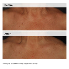 5% Face and Body Emulsion - Daily Care