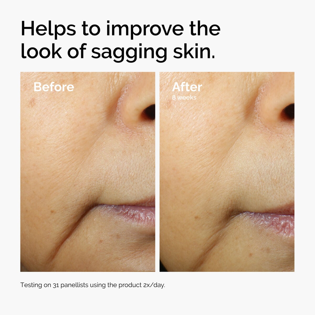 3% + Escin 1% Face Serum - Soft Balance