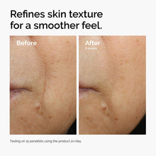 3% + Escin 1% Face Serum - Soft Balance