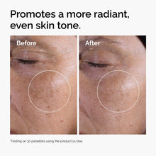 Acid 7% Exfoliating Toner - Gift Ready